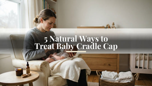 5 Natural Ways to Treat Baby Cradle Cap