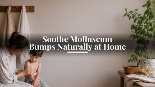 Soothe Molluscum Bumps Naturally at Home