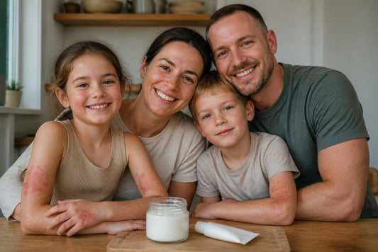 Tallow Balm vs Hydrocortisone for Eczema: 5 Key Facts